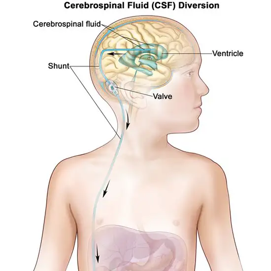 cerebrospinal fluid (csf)